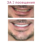 Стоматология Beauty Line на Никольской улице Фотография 11