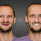 Научная стоматология Дантистофф на улице Столетова Фотография 9