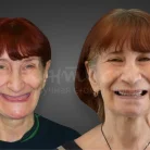 Научная стоматология Дантистофф на улице Столетова Фотография 14