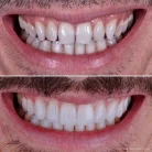Стоматология USMILE Фотография 3