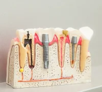 Стоматологическая клиника Happy Dents на набережной Академика Туполева Фотография 2