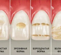 Клиника семейной стоматологии Денталис Фотография 2