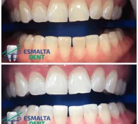 Стоматологическая клиника Esmalta Dent Фотография 2