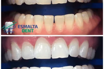 Стоматологический центр Esmalta Dent Фотография 2