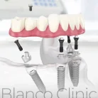 Стоматологическая клиника BLANCO Фотография 3
