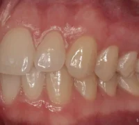 Клиника стоматологии Lbms Фотография 2