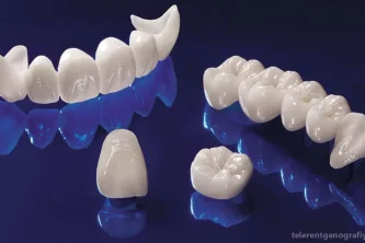 Стоматологическая клиника Дентекс С. Л. Фотография 2