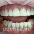 Стоматологическая клиника Доктор Неболитъ на улице Адасько Фотография 8