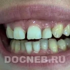 Стоматологическая клиника Доктор Неболитъ на улице Адасько Фотография 2